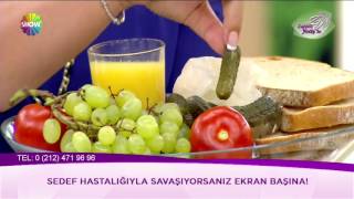 Sedef hastalığıyla savaşıyorsanız bu besinlere dikkat!