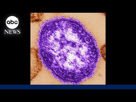 2 people die from measles in Pennsylvania, marking state's first deaths in 35 years