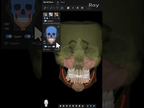 SMARTDent : 5D Tutorial #1-3. 3D Opacity Control