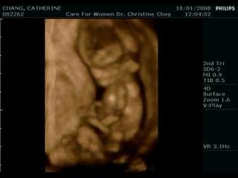 moving baby 18-01-2008