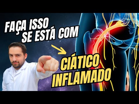 INFALÍVEL!😱 COMO TRATAR A DOR NO CIÁTICO COM APENAS 1 EXERCÍCIO