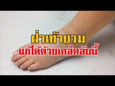 น้ำมันสำหรับโรคสะเก็ดเงิน Tar Berestovoy สำหรับโรคสะเก็ดเงิน