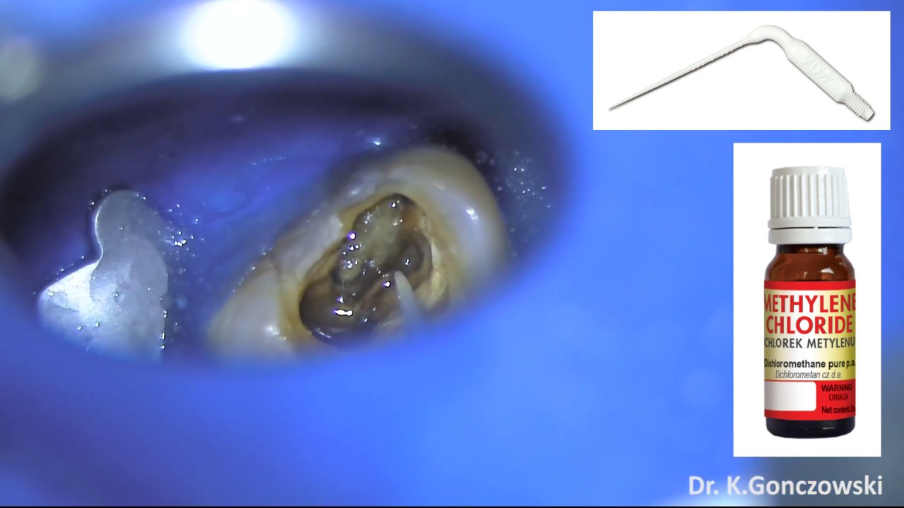 Krzysztof Gończowski-41