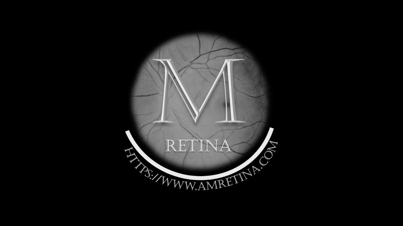 PPV for Diabetic Vitreous Hemorrhage