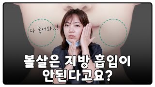 볼살은 지방 흡입이 안된다는 말을 들었다고요? 사실입니다.. 얼굴지방흡입 궁금한 것 전부 알려드립니다..!