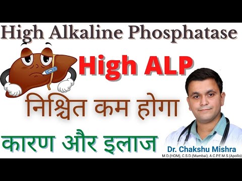 High alkaline phosphatase (ALP) in LFT causes & treatment. Signs of liver damage #RxHpathy
