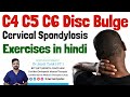 C4 C5 C6 disc bulge exercises in hindi | Cervical c4 c5 c6 c7 disc herniation Exercise at home