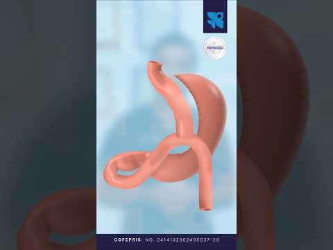 Ernesto Plasencia Camacho-6