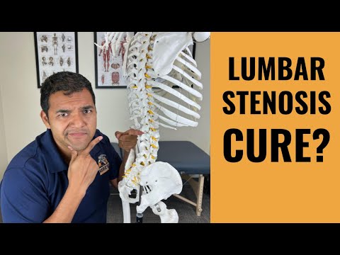 Can Painful Lumbar Spinal Stenosis Actually Be Cured? (Controversial)