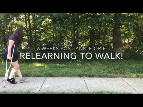 My Ankle ORIF Surgery Recovery: Relearning to Walk!