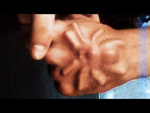 I vermi che vivono in coppie Relazione su un parassita della persona