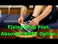 Fixing Drop Foot Absolute BEST Option When It Wont Get Better