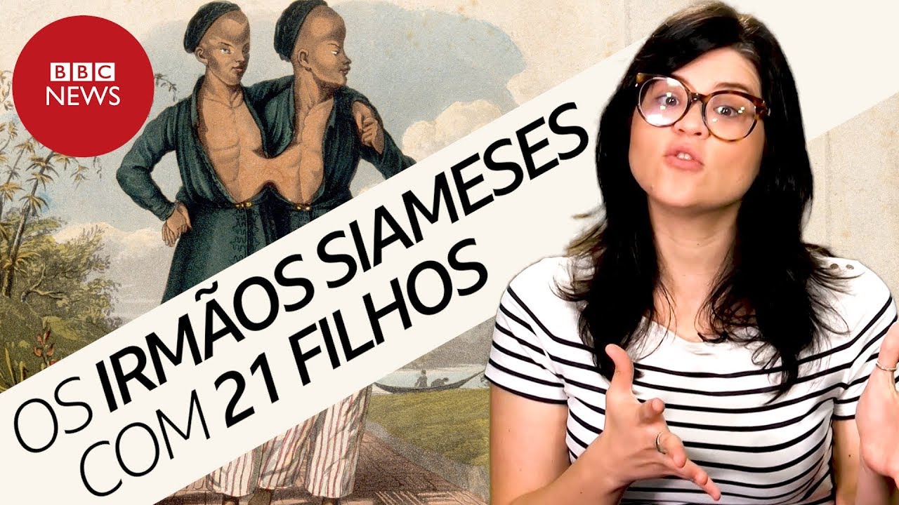 A fascinante história dos gêmeos siameses Chang e Eng