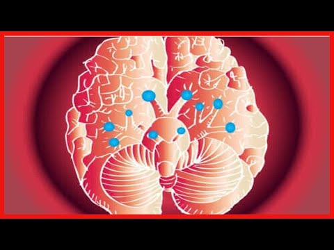 Die Funktionen der zwölf Hirnnerven