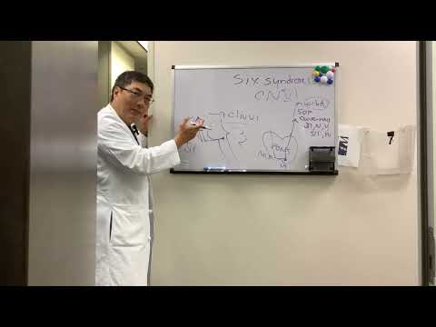 Clivus lesion causing 6th nerve palsy