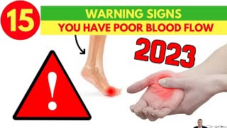 💗 15 Scary Warning Signs You Have Poor Blood Flow Circulation That You Can’t Ignore