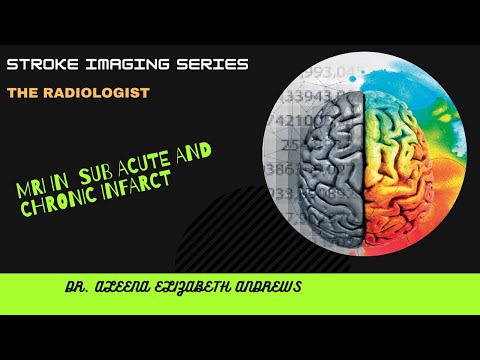 #Stroke_Imaging_Series  MRI subacute and chronic infarct  (Lecture 5)