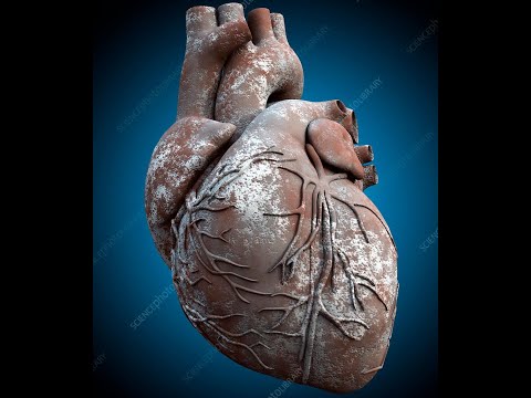 Ezekiel 11:19, 36:26 What is the stony heart God will remove from Israel/mankind?