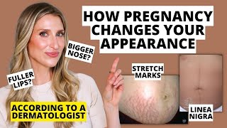 Dermatologist Explains How Pregnancy Changes Your Skin, Hair, & Nails