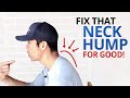 4 Exercises to Fix Dowager's Hump (Neck Hump) & Poor Posture for GOOD