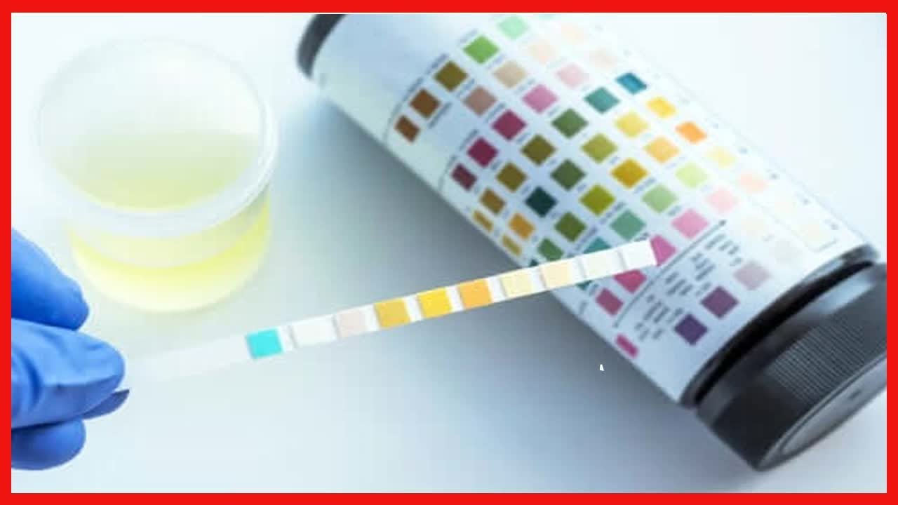 Que détecte une analyse d'urine 