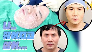 성형외과대표원장 #실리프팅 해봄???? #아이루미성형외과 #트리플리프팅