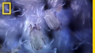 Secret Life of Dust Mites | I Didn