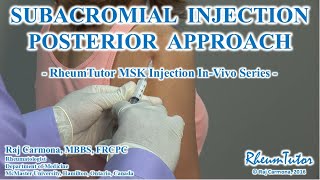 SUBACROMIAL SHOULDER INJECTION - POSTERIOR APPROACH: Step-By-Step Procedure