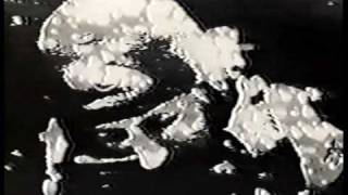 Internal Bleeding - Anointed in Servitude