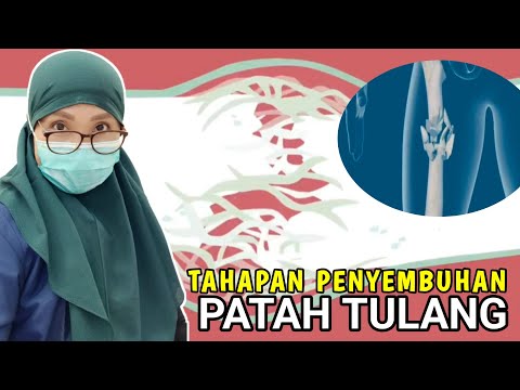 tahapan penyembuhan patah tulang || Patah tulang bisa Sembuh sendiri