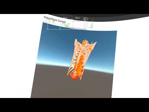 DICOM 3D Visualization using Unity Render Streaming and Oculus Quest2