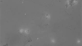 Awesome Neutrophil Video