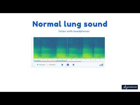 Normal lung sound