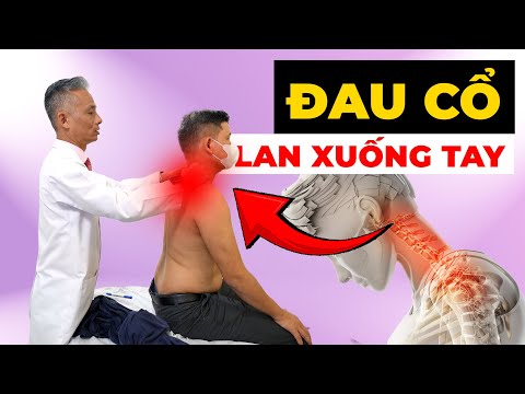 Đau Cổ Lan Xuống Tay Tê Mỏi - Nguy Hiểm Khôn Lường Nếu Bạn Còn Chủ Quan