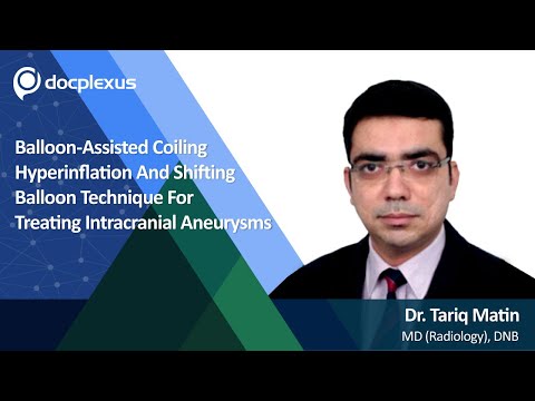 Balloon-assisted Coiling Hyperinflation: A Better Approach for Intracranial Aneurysms