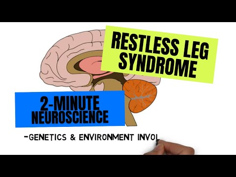 YouTube video about: What is restless leg syndrome?