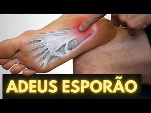 COMO CUREI O ESPORÃO CALCANEO SEM CIRURGIA?