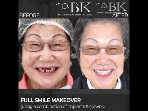 Sumiko's Full Smile Makeover at DrBK Sumiko's Full Smile Makeover at DrBK