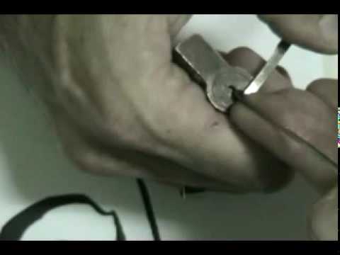 Breast koreksyon pagtitistis gastos Suso na may implants