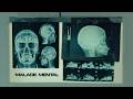 Mouka - Malade Mental ft Hanta & Ka3bi (Official Music Video)