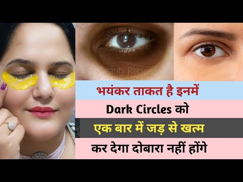 आंखों के काले घेरे / डार्क सर्कल्स का घरेलू इलाज || Dark Circles Treatment #darkcircles #summer