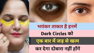 आंखों के काले घेरे / डार्क सर्कल्स का घरेलू इलाज || Dark Circles Treatment #darkcircles #summer