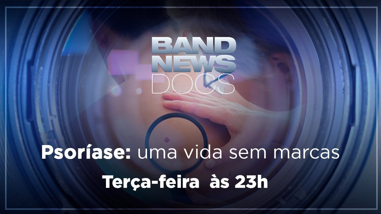 BandNews DOCs - Psoríase: uma vida sem marcas