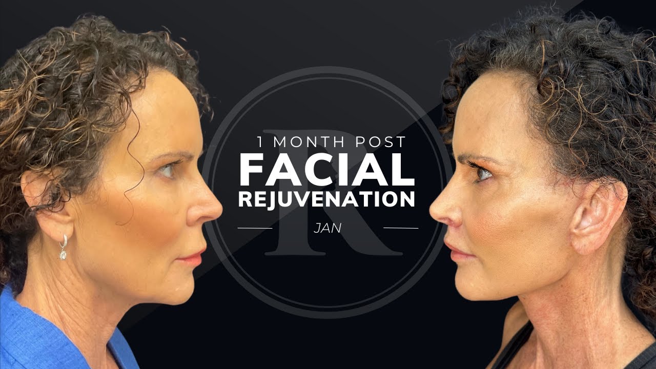 Robb Facial Plastic Surgery