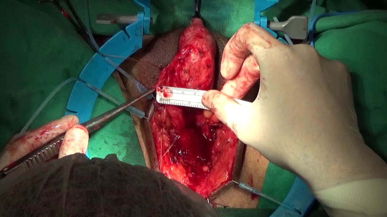 Luis Otávio Pinto-8