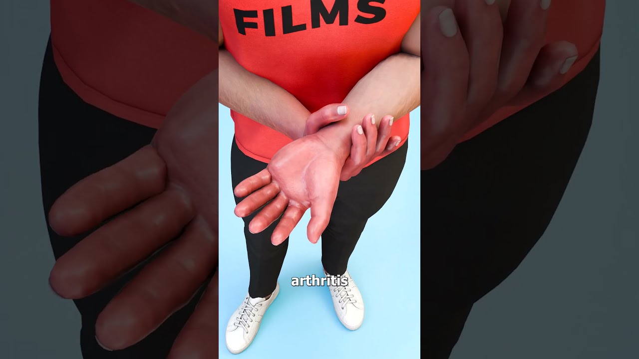 How Bee Sting Therapy Works 😮