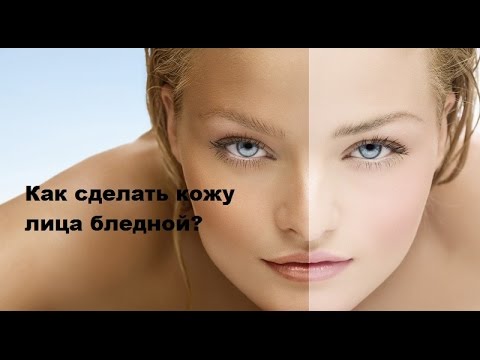 При солнце веснушки Что такое купероз и пигментные пятна
