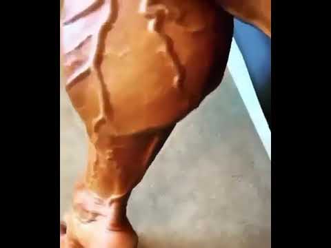 Calves muscle Activated