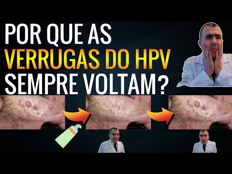 Cancer causing hpv