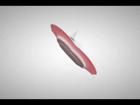 Smith & Nephew | ALLEVYN Life aanbrengen
